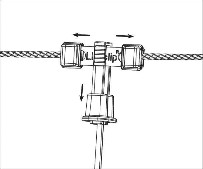 Litzclip® Reparaturset für Vertikalstreben in Weidenetzen